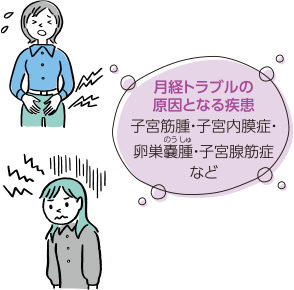 月経トラブルの原因となる疾患 子宮筋腫・子宮内膜症・卵巣嚢腫・子宮腺筋症など